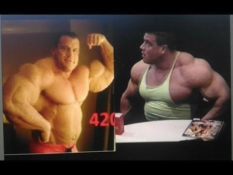Greg Kovacs: el culturista que no podía limpiarse el cuIo