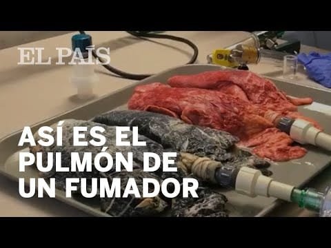 ¿Cómo se va transformando el pulmón de un fumador?