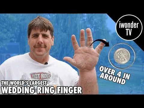El hombre que tiene el anillo de boda más grande del mundo